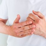 Eczema prescription online