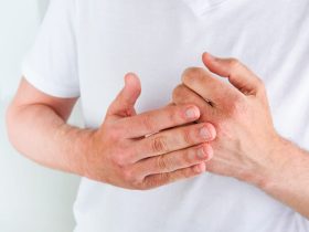 Eczema prescription online