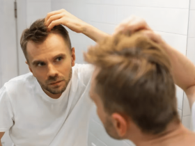 online hair loss treatment service