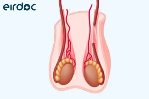 Affordable Vasectomy in Dublin | Online Doctor Ireland