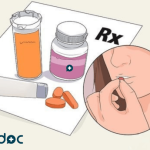 Thrush Treatment: Quick Relief for Men and Women